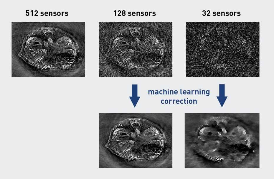 Artificial intelligence improves biomedical imaging 1