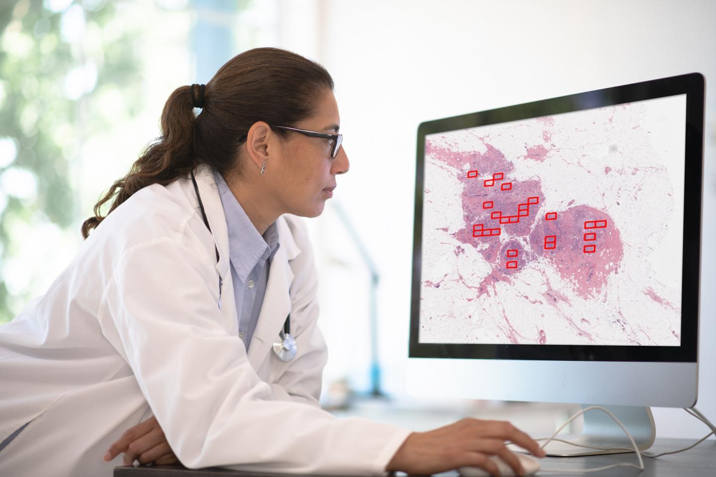 A new kind of artificial intelligence provides breakthrough in breast cancer diagnosis 1